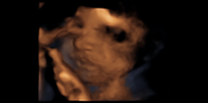 28 weeks pregnant 3D scan mothership 